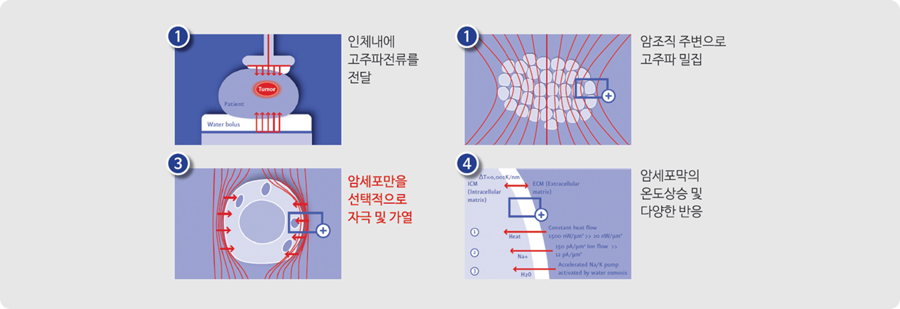 치료과정